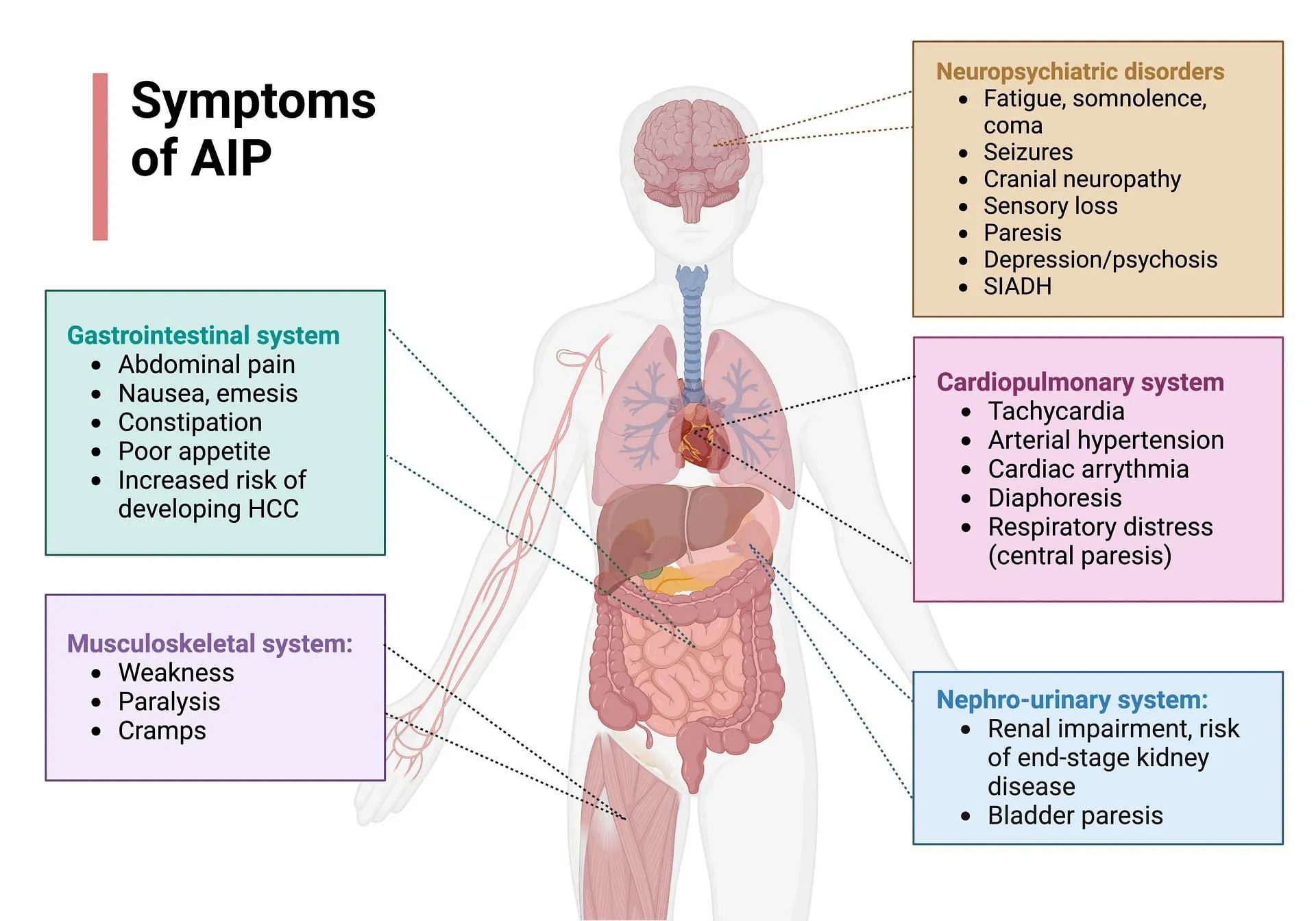 L'AIP è la più comune e quella associata ai sintomi psichiatrici.  (Immagine tramite Lightbox/Lightbox)